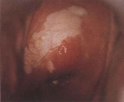 �����װ�ͼƬ