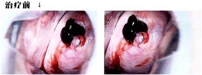 ����Ϣ���ͼƬ